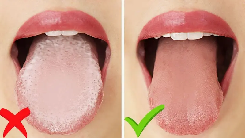 Tongue scraper before and after